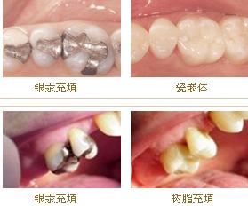 郑州专业的烤瓷牙医院是哪个